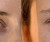 Wimpernlifting-Sets – Ranking